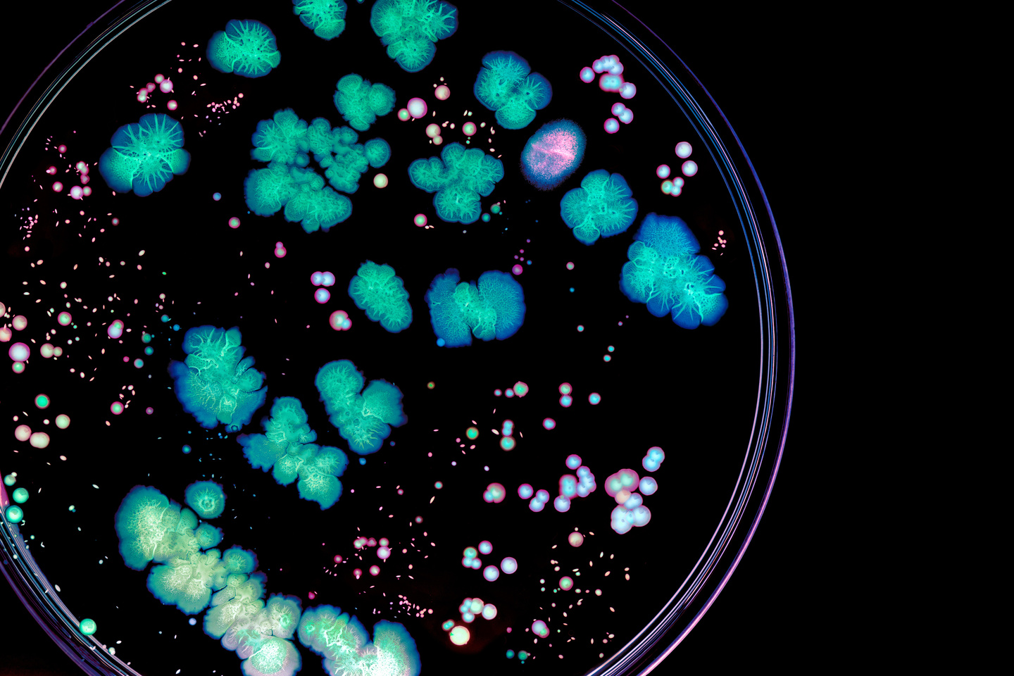 Bacterial or fungal Isolation